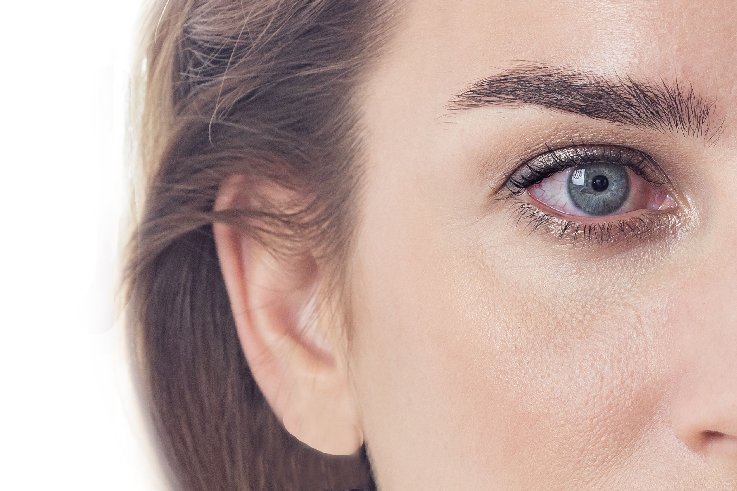 Dry Eye Syndrome: What to Know